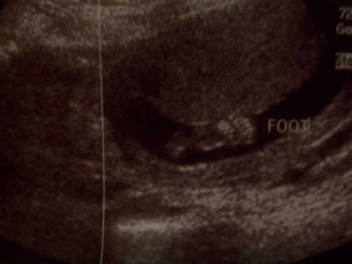 16 Week Ultrasound II