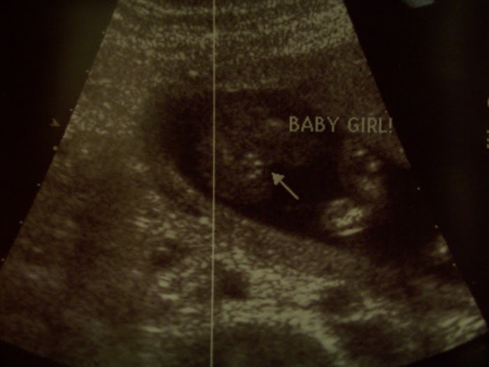 16 Week Ultrasound III