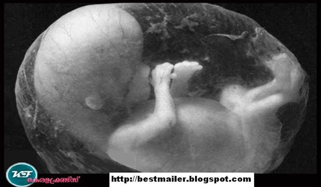 Various complications during pregnancy