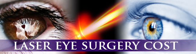 laser eye surgery cost