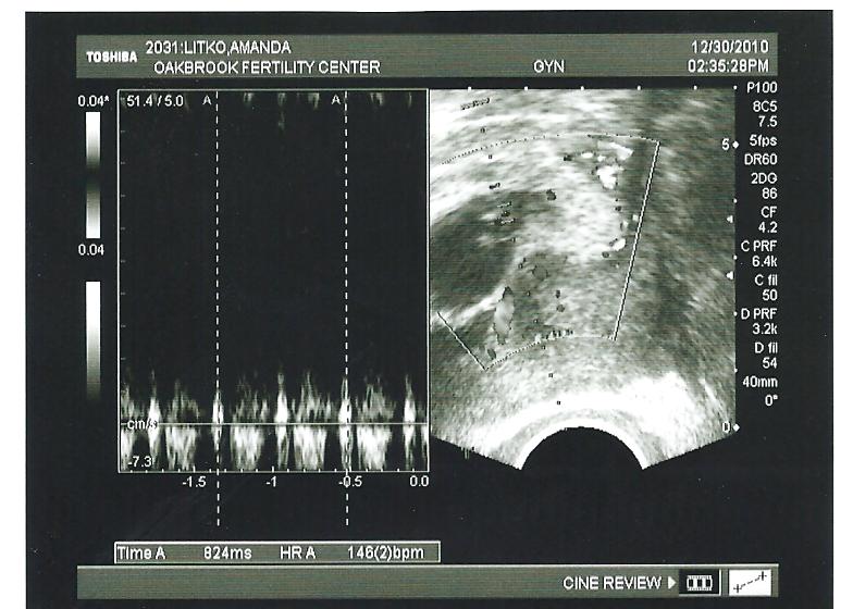 From Here To Maternity u/s 7w2d exponential growth