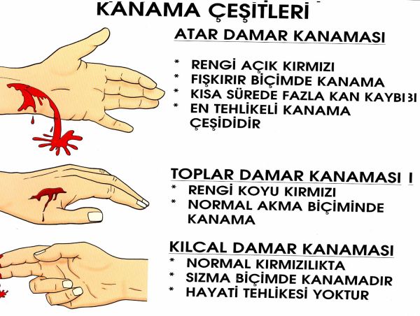 [resim2_1237921286.jpg]