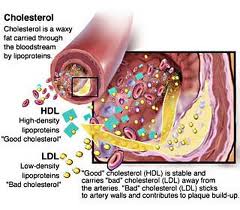 Health World: All about : Foods to Avoid High Cholesterol