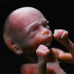 [Image: fetus20+weeks.jpg]