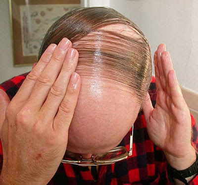 combover5yp.jpg