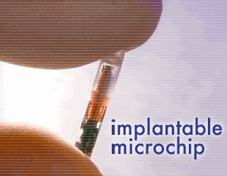 [implantablemicrochip.gif]