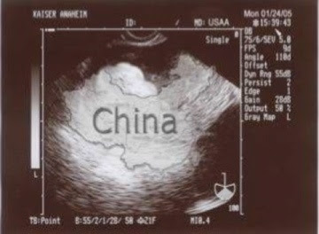 Image result for china ultrasound pic