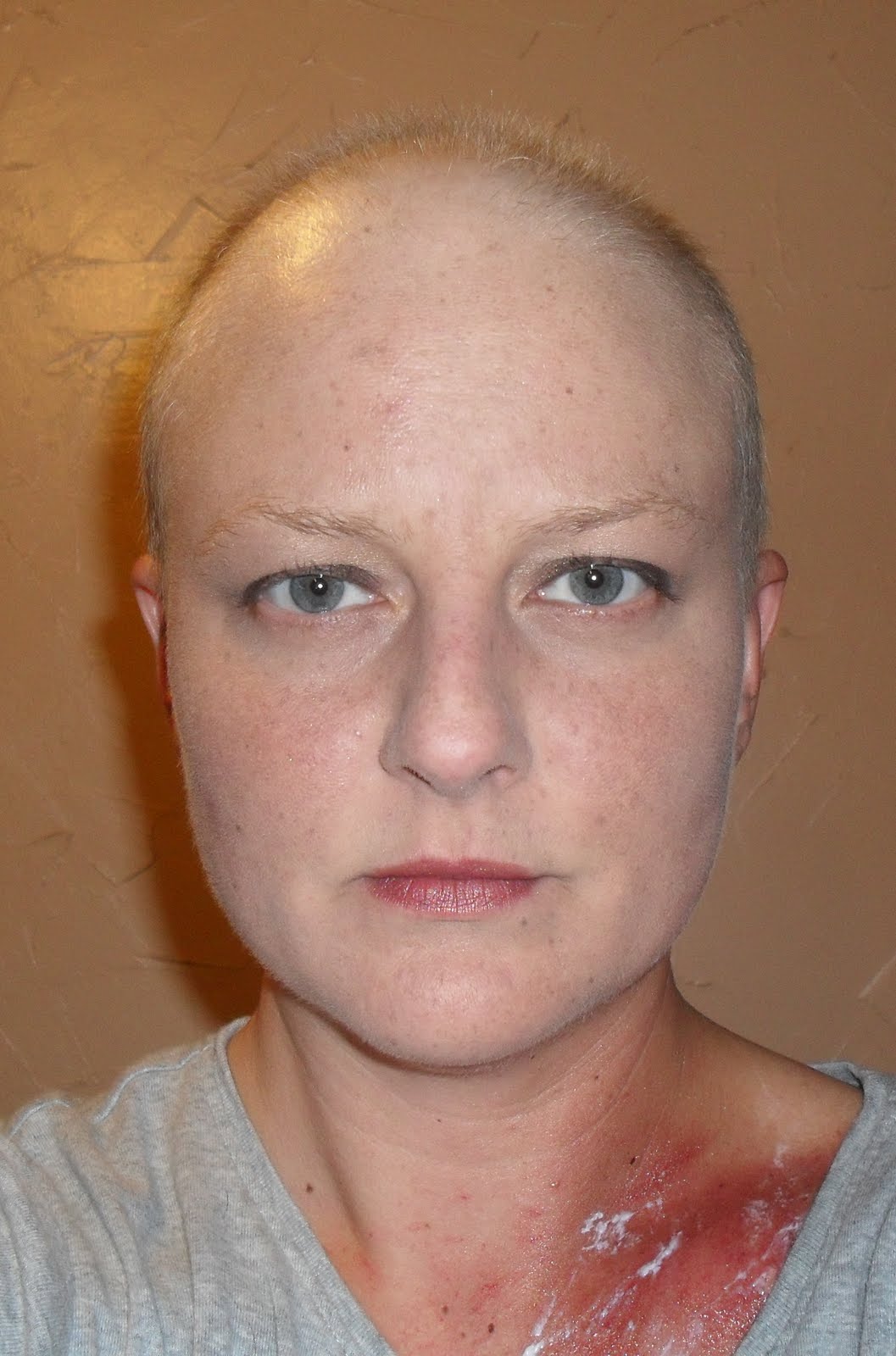 So THIS is what it's all about? Cancer Impatient...