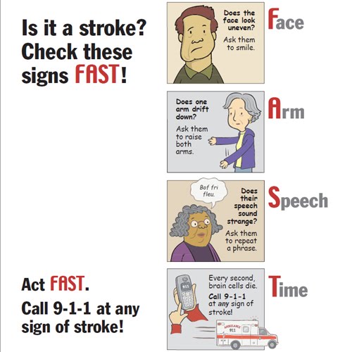 Signs of a Stroke Southern Stroke Awareness Society