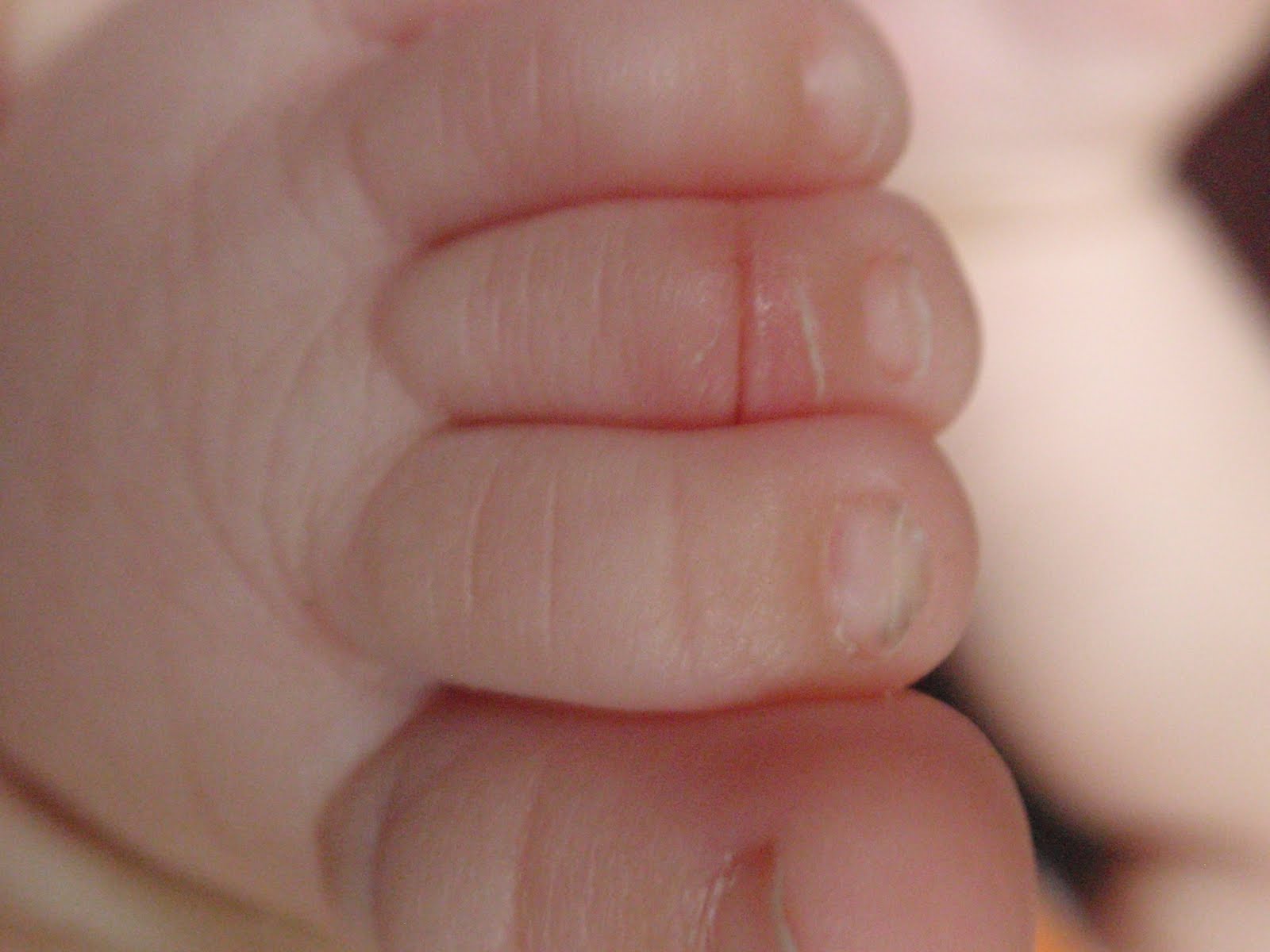 The Expectant Life The Hair Tourniquet Love Deeply, Hold Loosely