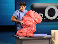 re: the 140 pound tumor crosses the line