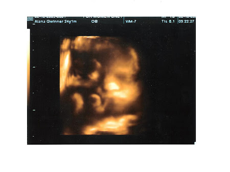 3D picture from 29 weeks