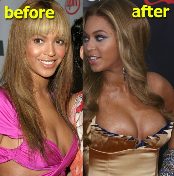 Celebrity Boob Jobs Before And After 21