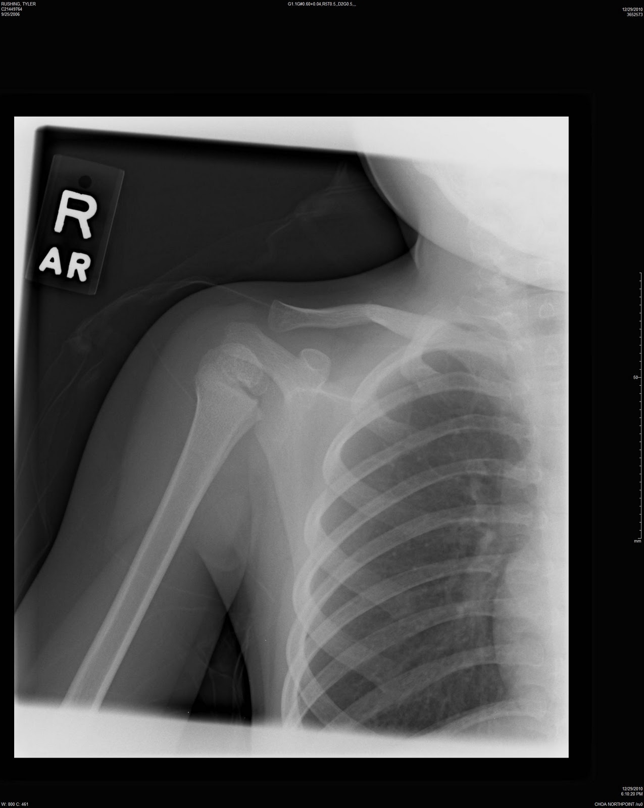 Pigs' Tales December 2010