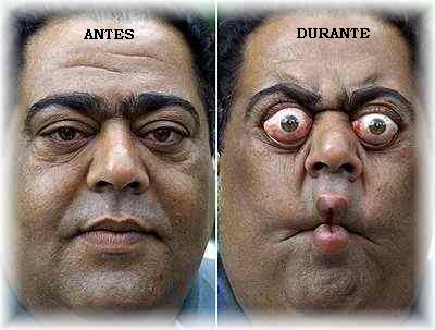 [exame-de-prostata.jpg]