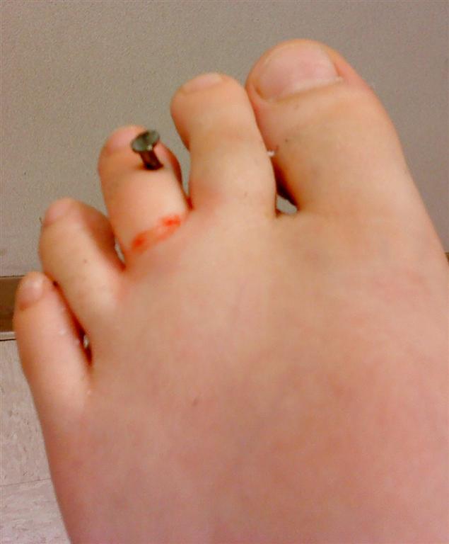 Jeff & Suzi Clines Family Blog Nail gun and a bad aim