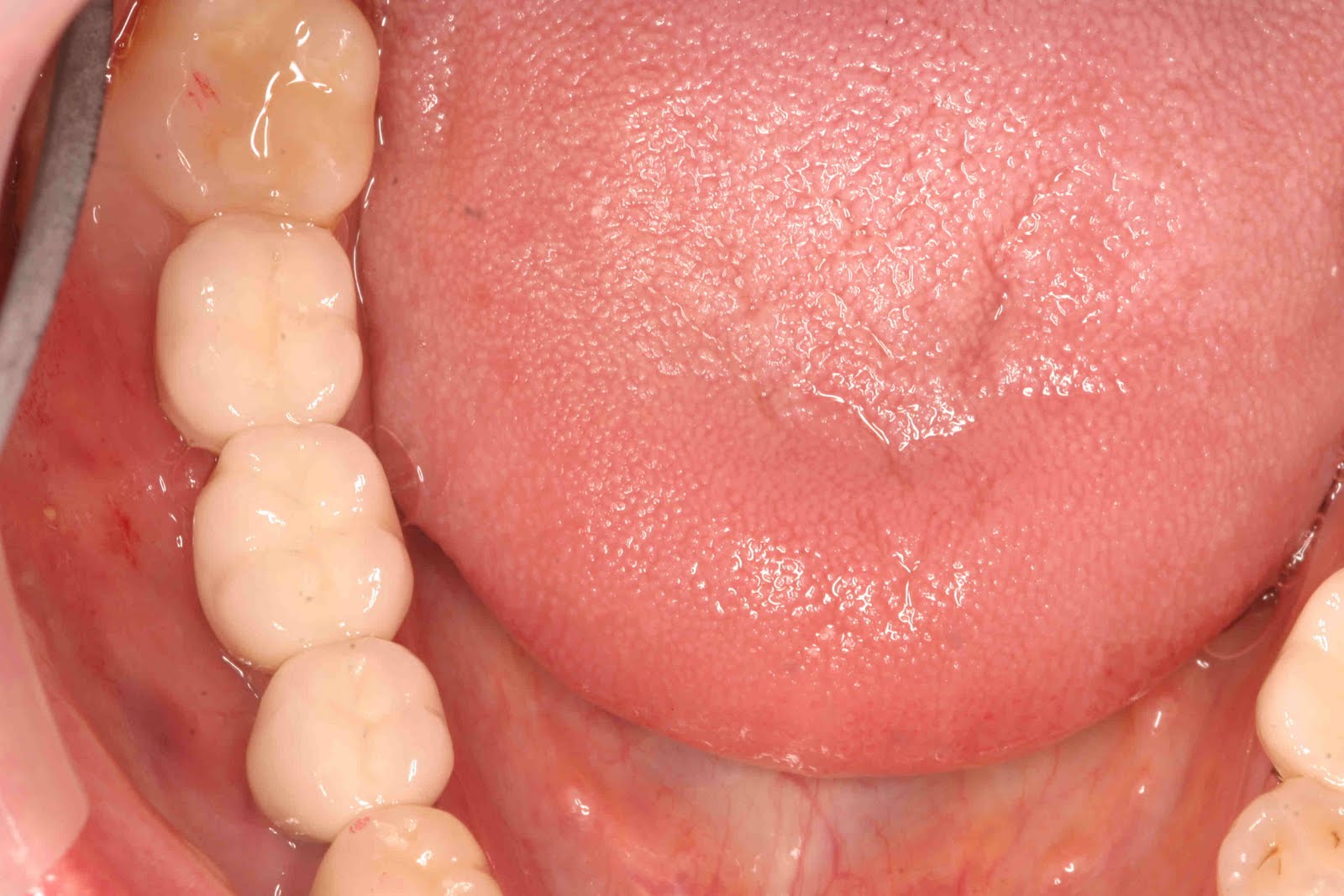 Austin Cosmetic Dentist Lakeway Dentist Dr Tejas Patel Lakeway