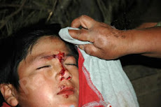 Niños mapuche heridos