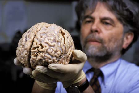 [20070330171548-cerebro-humano.jpg]