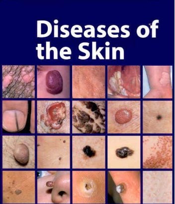 types of skin diseases