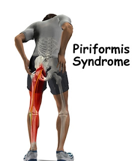  piriformis_intro01.j