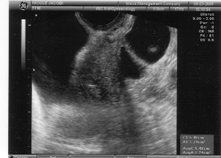 Condor Embryo The Magical Cycle