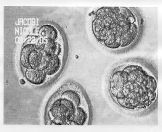 Condor Embryo The Magical Cycle
