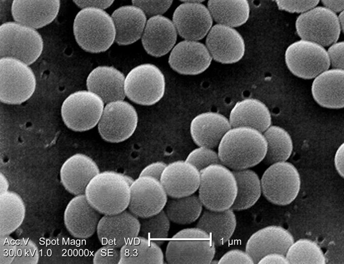 AA 上宇部こどもクリニック ブドウ球菌性熱傷様皮膚症候群 AA 上宇部こどもクリニック ブドウ球菌性熱傷様皮膚症候群