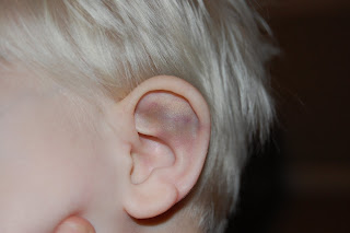 Me and My Monkeys: Bridger and the Case of the Bruised Ear