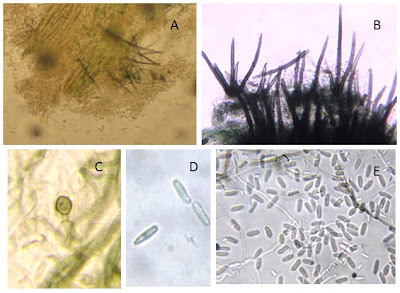 Doenças do Abacateiro: Antracnose (Colletotrichum gloeosporioides ...