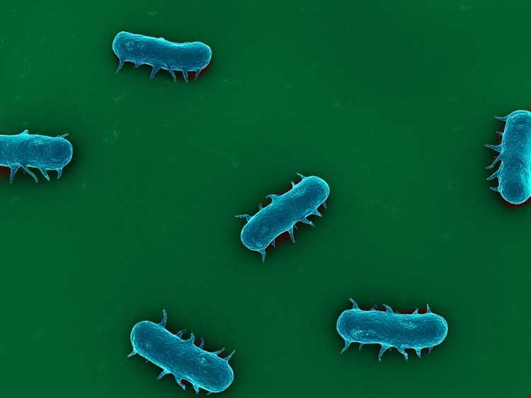 Salmonella enterica