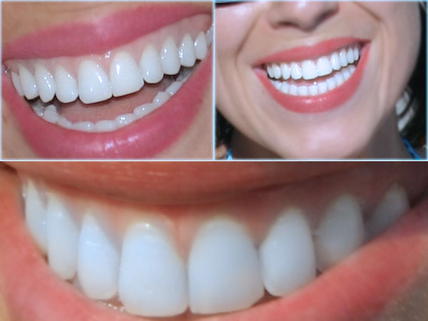 [Diş+Sağlığının+Önemi.jpg]