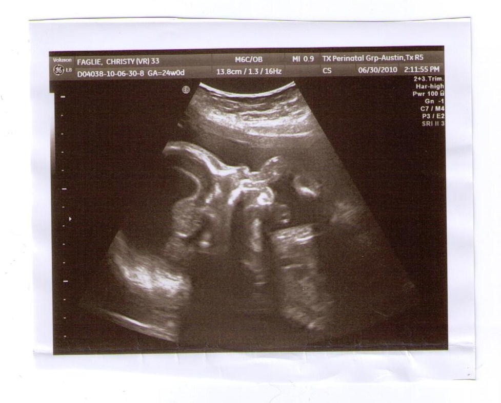 baby sonogram baby sonogram