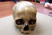 Allegedly the Skull of Count Von Donop