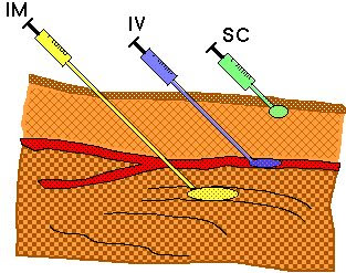 mynsgnotes.blogspot.com: Intravenous Injection (IV INJECTION)