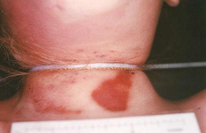 Criminal Descubierto: JonBenét Ramsey: "Caso sin Resolver"