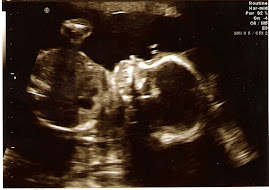 22 weeks