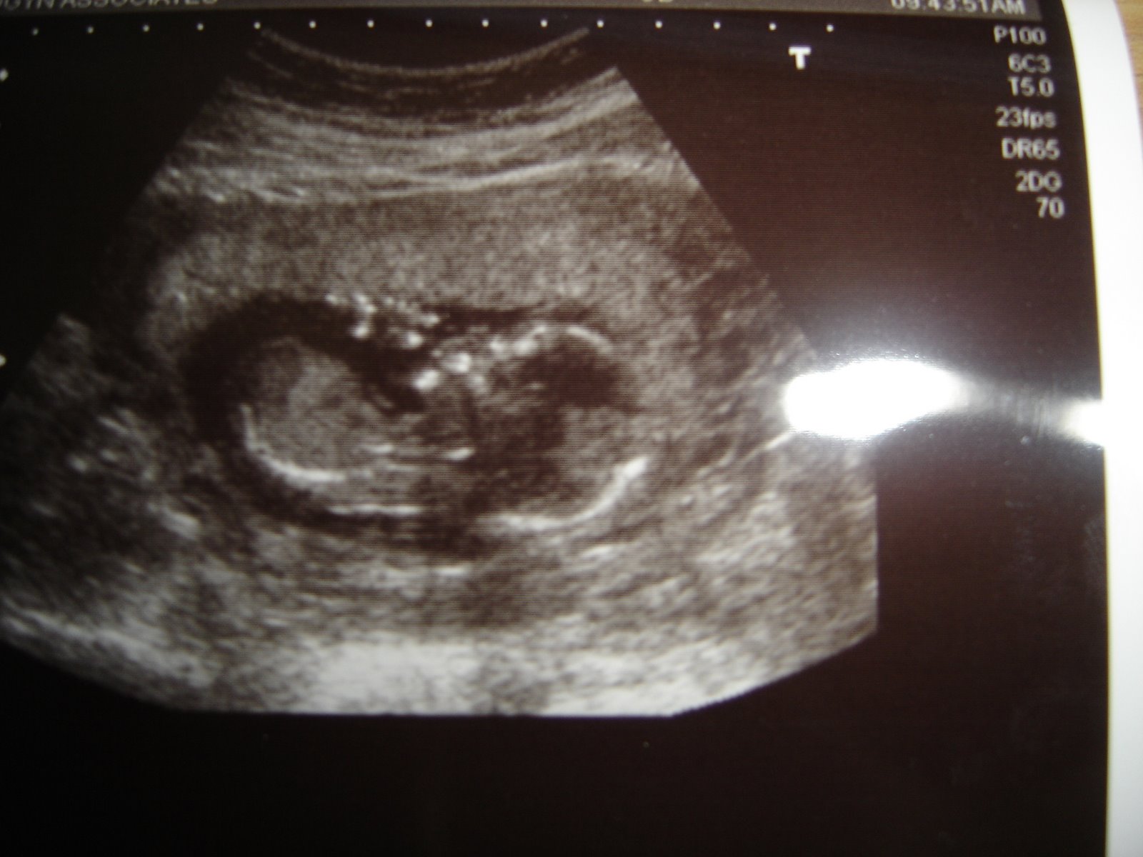 [14weeks.jpg]