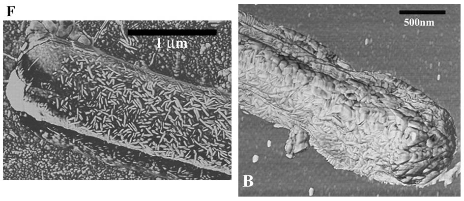 [Streptomyces_AFM.jpg]