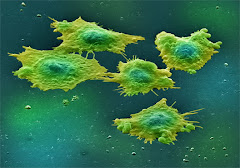 Colon Cancer cells
