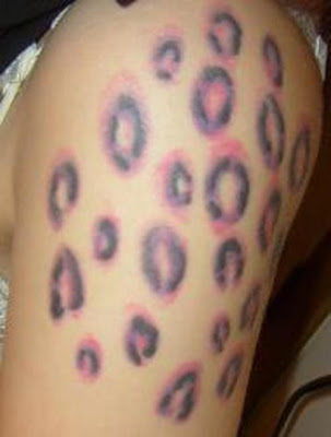 the set of paw print tattoos placed unconventionally, and prominently,