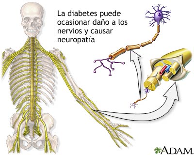 nervio trigemino afectado sintomas de diabetes