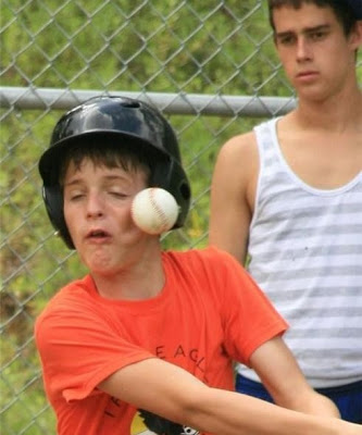 Pelotazo de beisbol en la cara