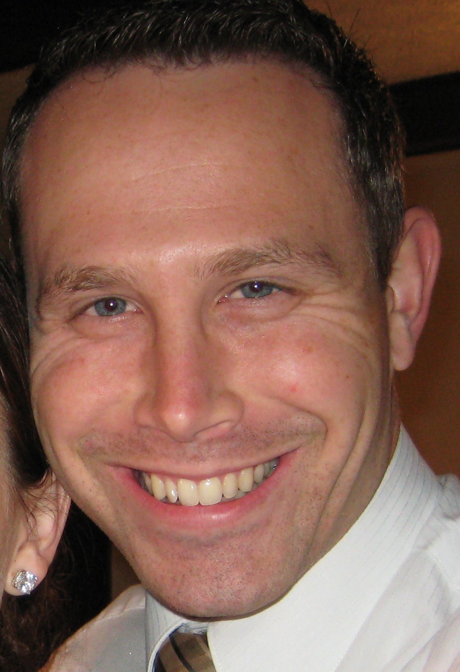 My Face why does one eye open more than the other?