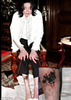 michael+leg.jpg