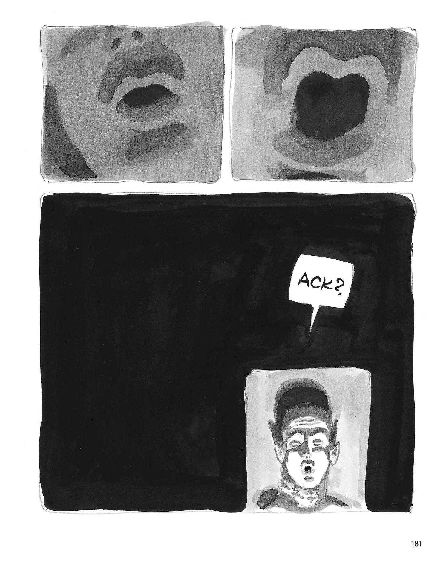 Read online Stitches: A Memoir comic -  Issue # TPB (Part 2) - 81